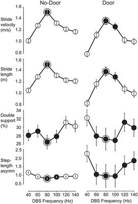 Chronic Subthalamic Nucleus Stimulation in Parkinson's Disease: Optimal Frequency for Gait Depends on Stimulation Site and Axial Symptoms